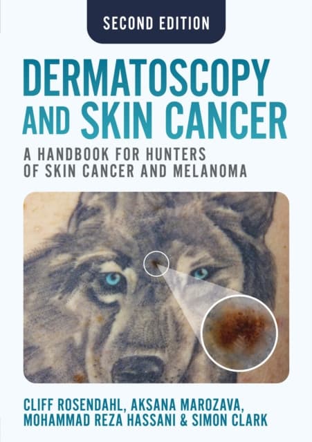 Dermatoscopy and Skin Cancer, second edition