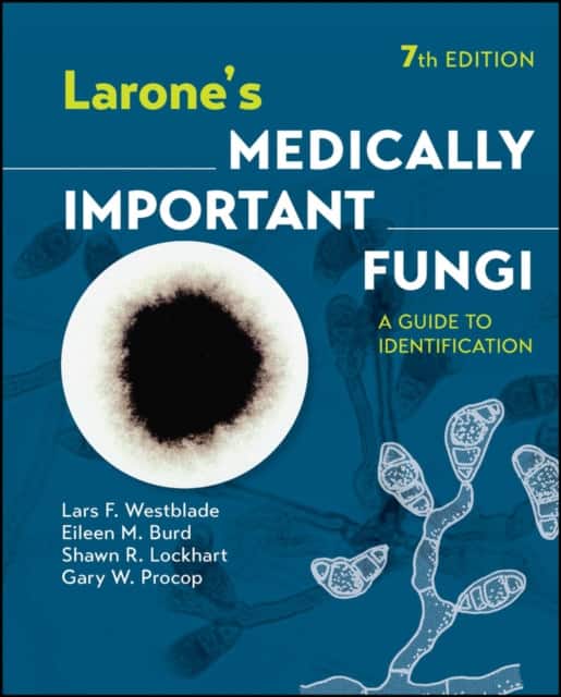 Larone′s Medically Important Fungi av Lars F. Westblade